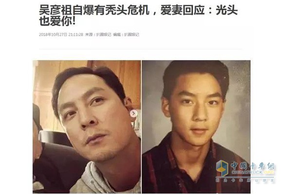 昔日男神已有秃头危机